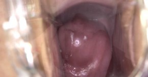 admirable crazy slut ashley jane with speculum shows the inside of her wet pussy, parkhotes
